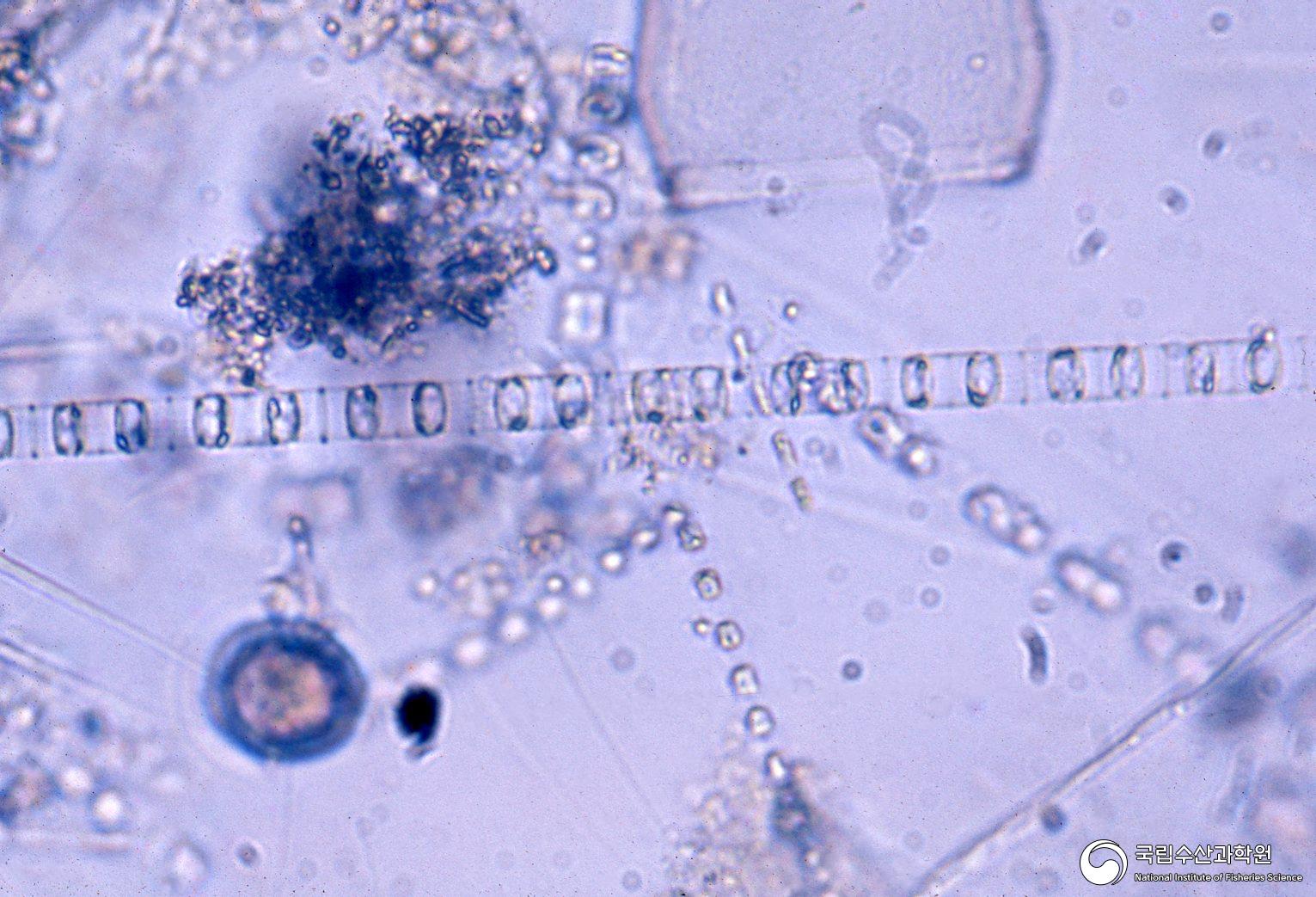 패류(식물플랑크톤) 먹이생물(현미경 검경, 1970년대) 01 사진